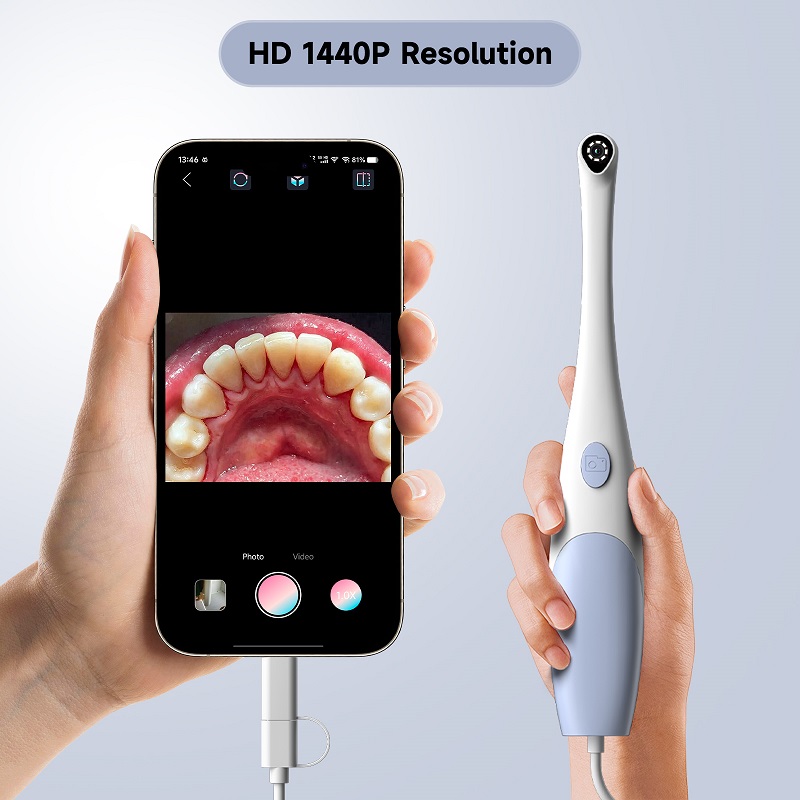 Oral Endoscope Camera 1440P Ph - Photography Lighting Handheld review and price