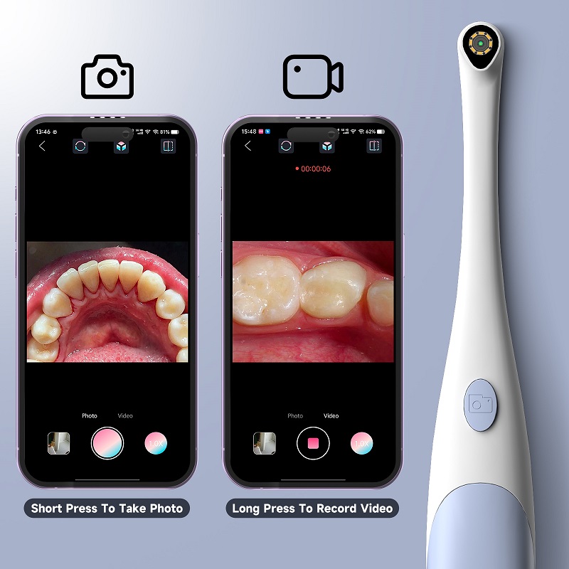 Oral Endoscope Camera 1440P Ph - Photography Lighting Handheld review and price