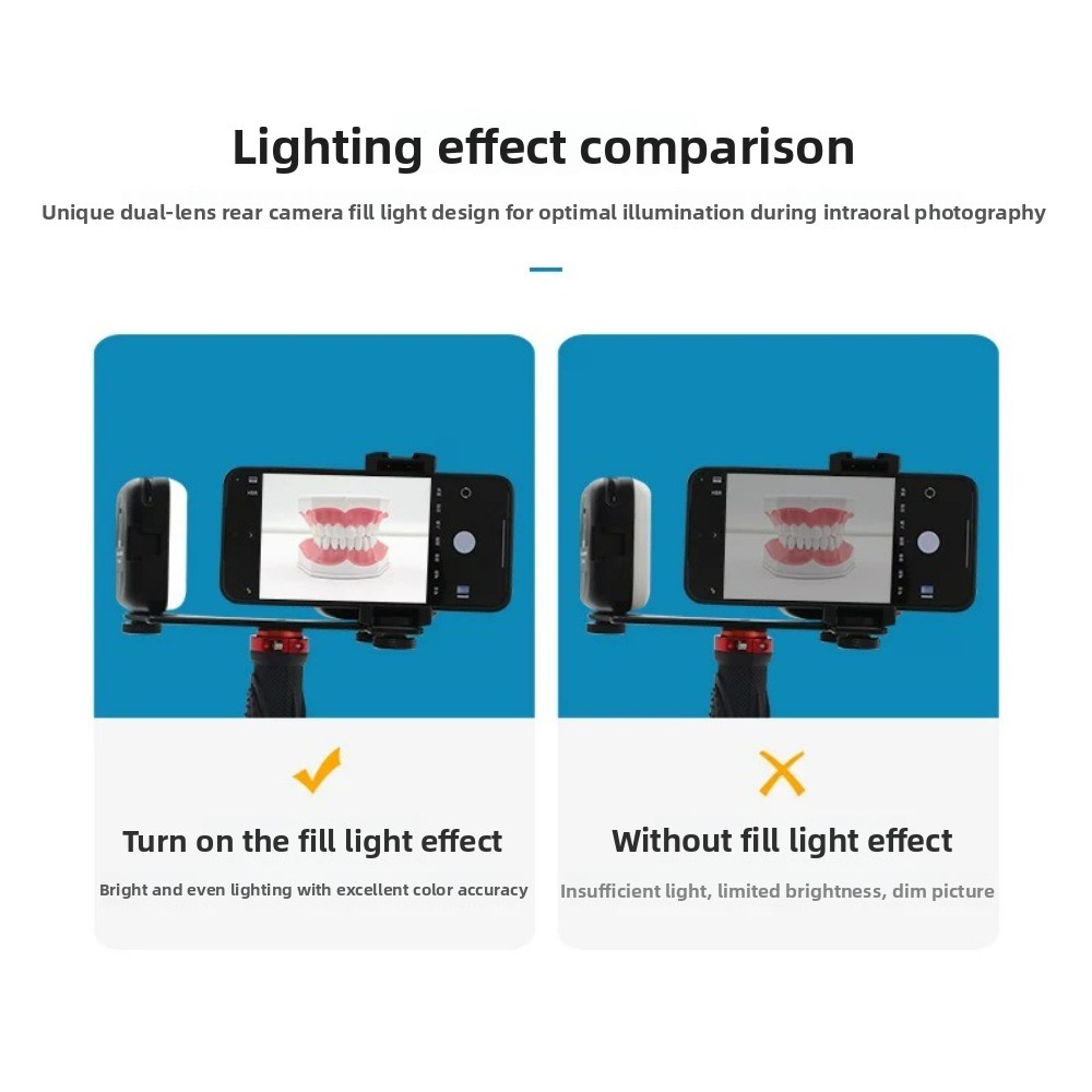Dental Photography Light, Blue - Photography Led Lighting Kit review and price